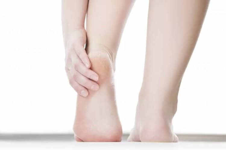 العلاجات المنزلية للأقدام المتشققة